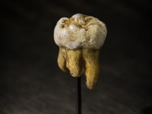 molar denisova